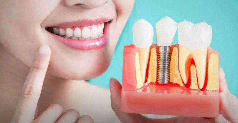 Какие бывают зубные протезы