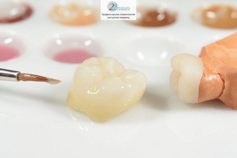 Зубные вкладки в стоматологии